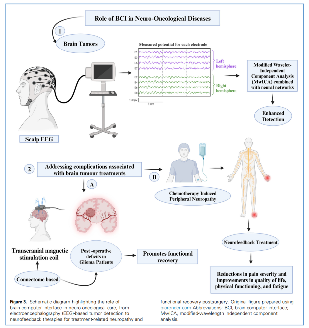 BCI 技术在神经肿瘤疾病中的应用.png